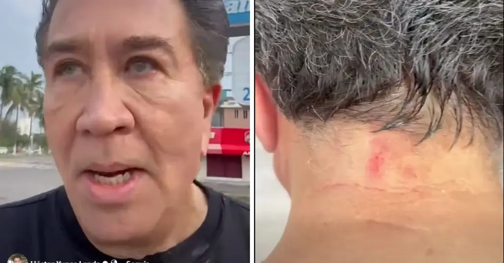 Asaltan a Héctor Yunes mientras corría en el bulevar de Boca del Río